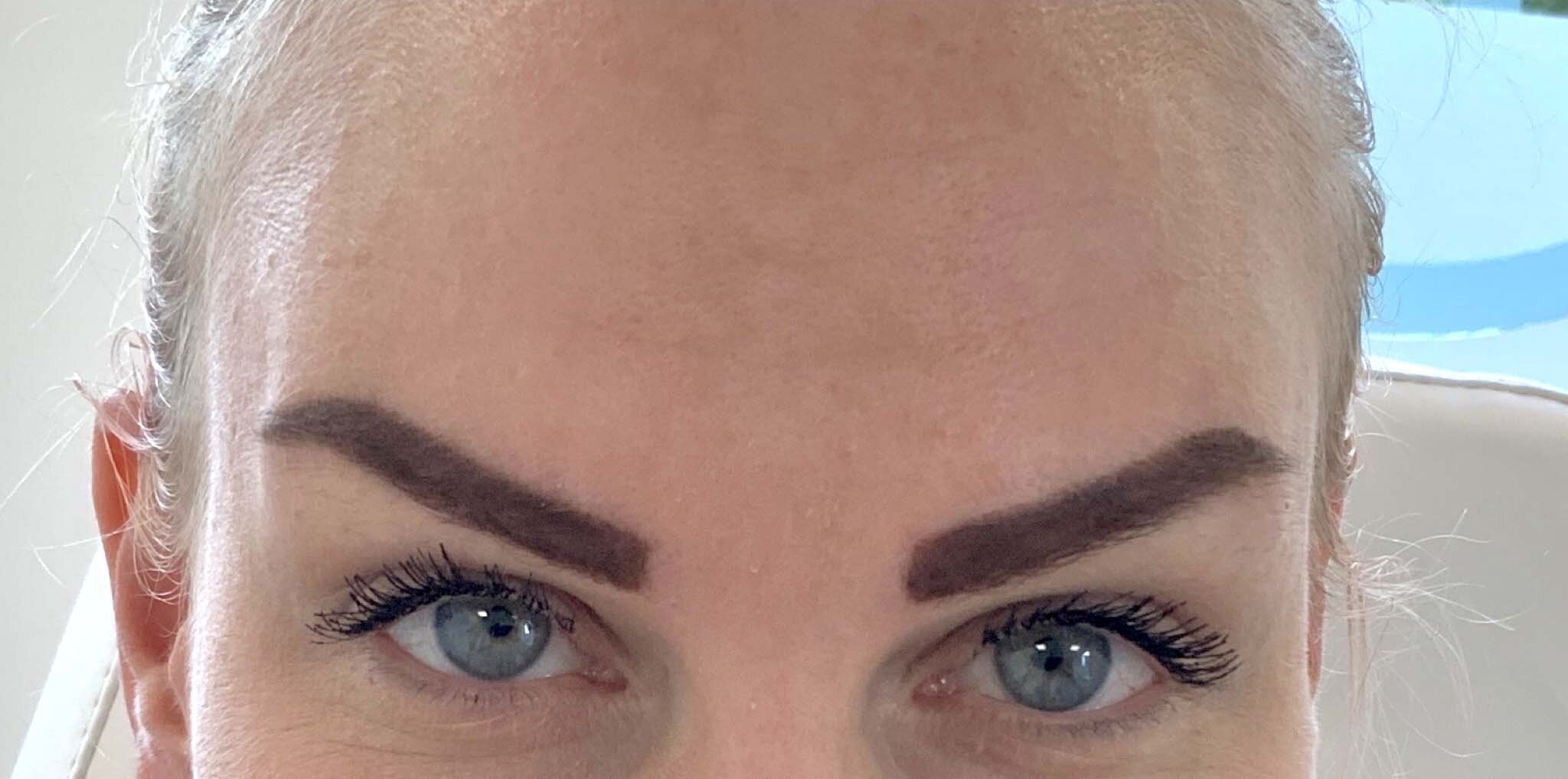 Startsituatie Botuline Toxine (Botox) bij kliniek 88