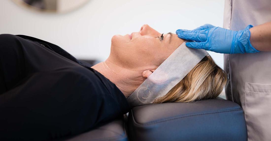 De microneedling behandeling bij Kliniek 88